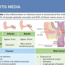 Nursing care plan for otitis media