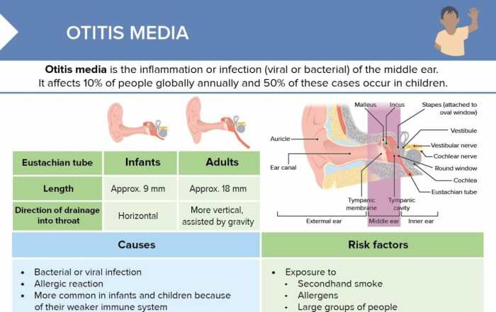 Nursing care plan for otitis media