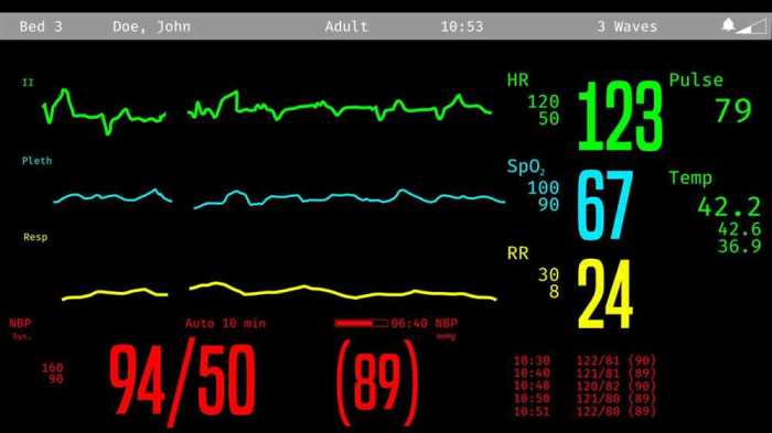 Ati virtual scenario: vital signs alfred answers